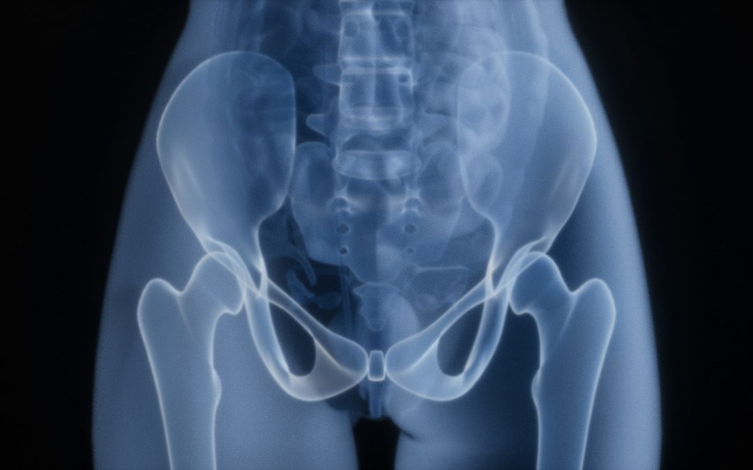 How Introverts Can Recover More Comfortably After Hip Replacement