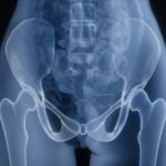 How Introverts Can Recover More Comfortably After Hip Replacement